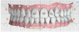 Dental Case Chart set up image