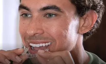 Man with clear aligner in his hands