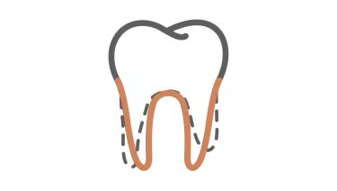 Spark Aligners TruRoot Feature - Position Icon