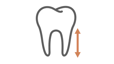Spark Aligners TruRoot Feature - Size Icon