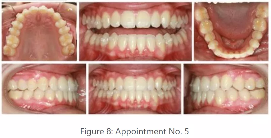 Photo panel taken on 5th Appointment by Dr. Pascale