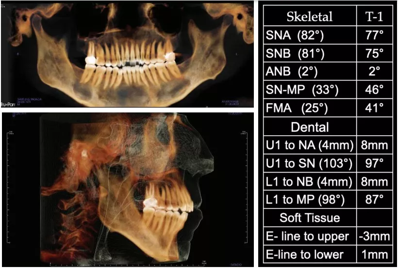 Bicknell Pretreatment Radiograph