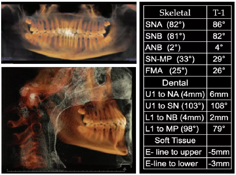 Bicknell case 2 Initial Radiograph