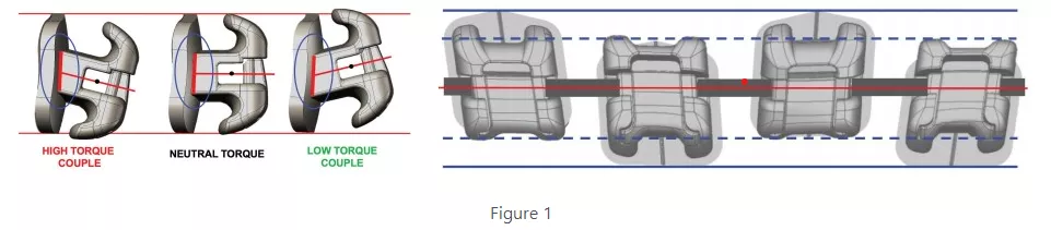 Bracket Vertical discrepancy diagram