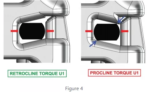 Diagram showing a Wire paired with a variable torque bracket