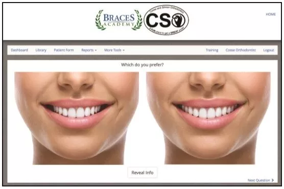 Screen shot of Braces Academy Referral Program Dr. Cosse's blog