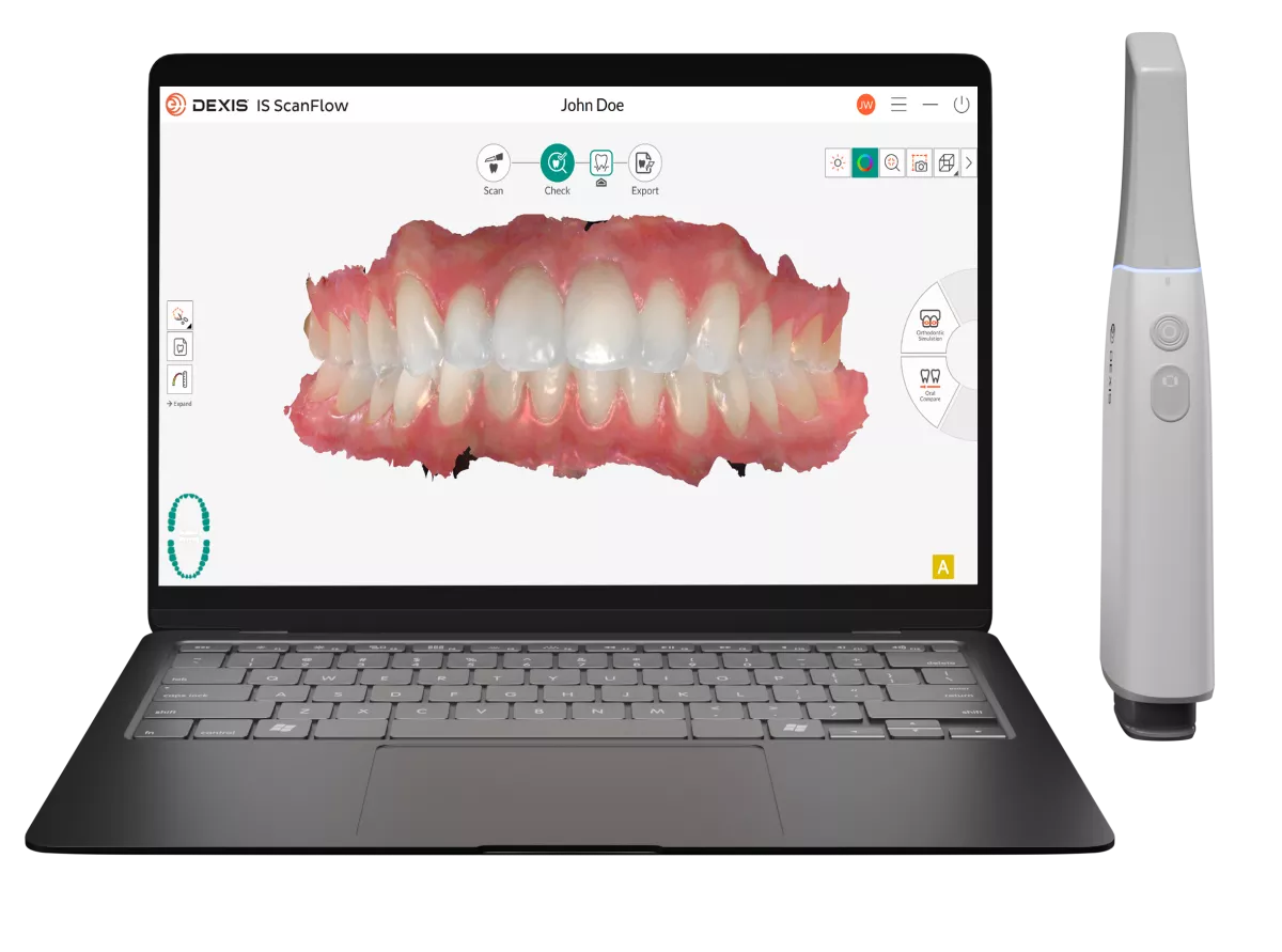 Laptop running DEXIS IS ScanFlow software next to a connected intraoral scanner.
