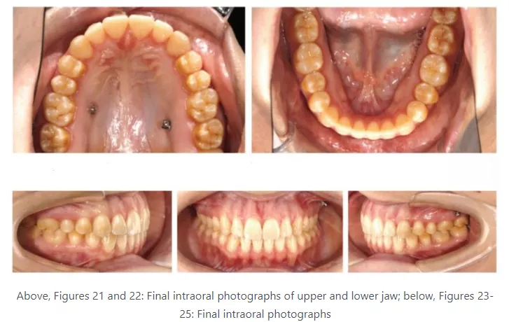Dr Peydro 7 treatments plan after treatment panel