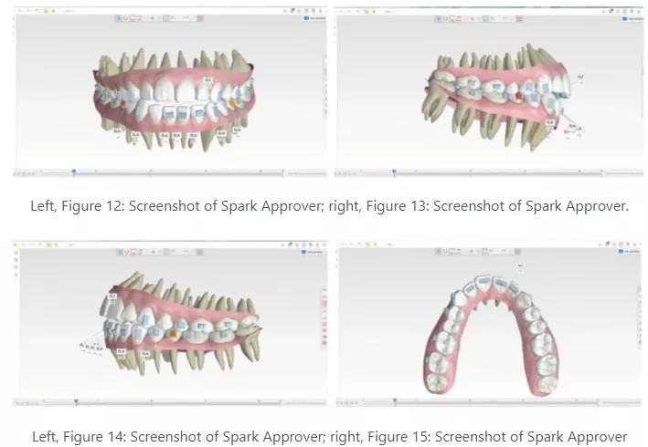 Dr. Peydro Spark Approver image panel during treatment