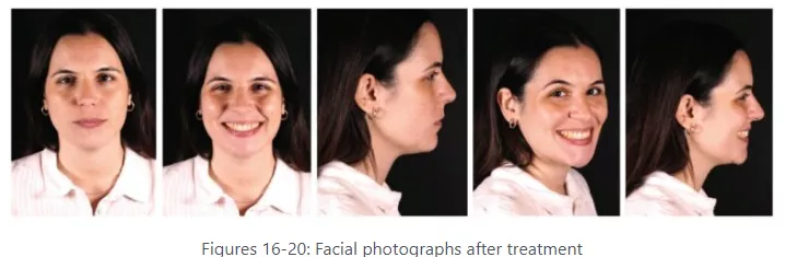 Dr. Peydro face images after seven treatments