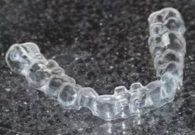 Picture of First clear aligner in detail.
