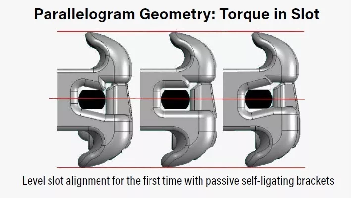 Diagram of bracket torque in slot