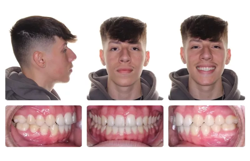 Bogdan Post Treatment Full Panel