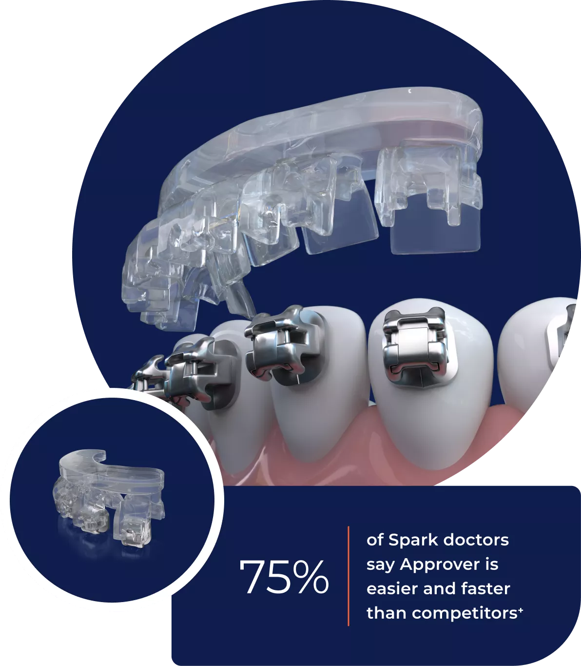 Ormco Digital Bonding
