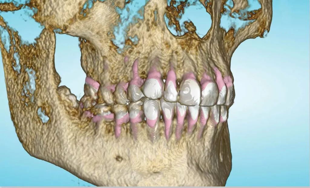 Spark Approver Image showing mouth