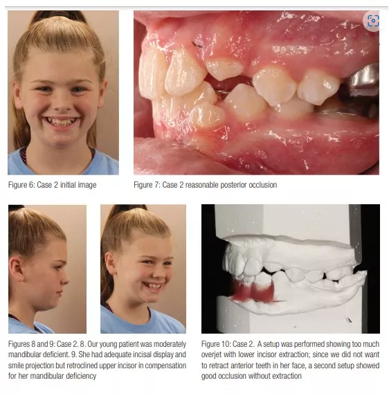 Sarver Case 2 full treatment panel