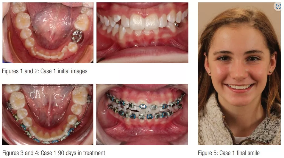 Sarver case 1 full treatment panel