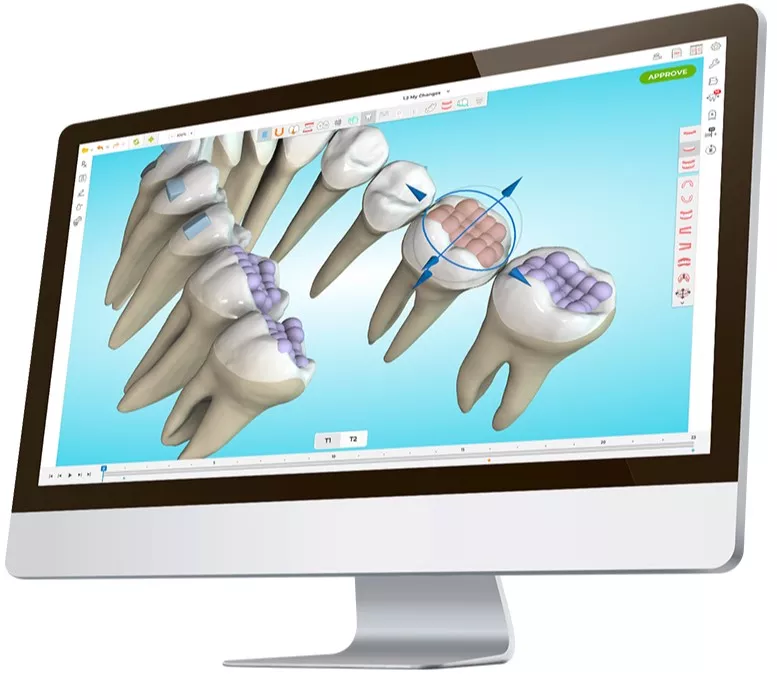 Ormco's Spark Approver Software shown on a Computer monitor