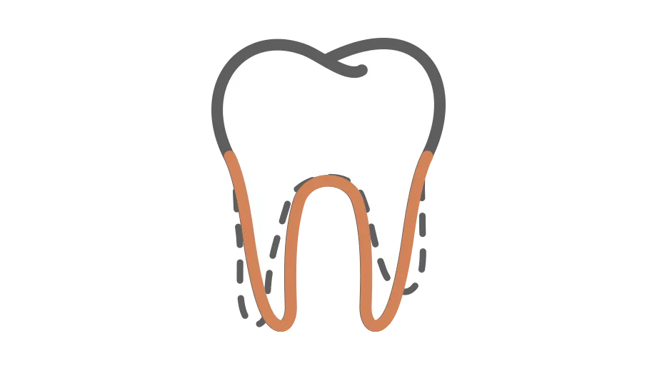 Spark Aligners TruRoot Feature - Position Icon