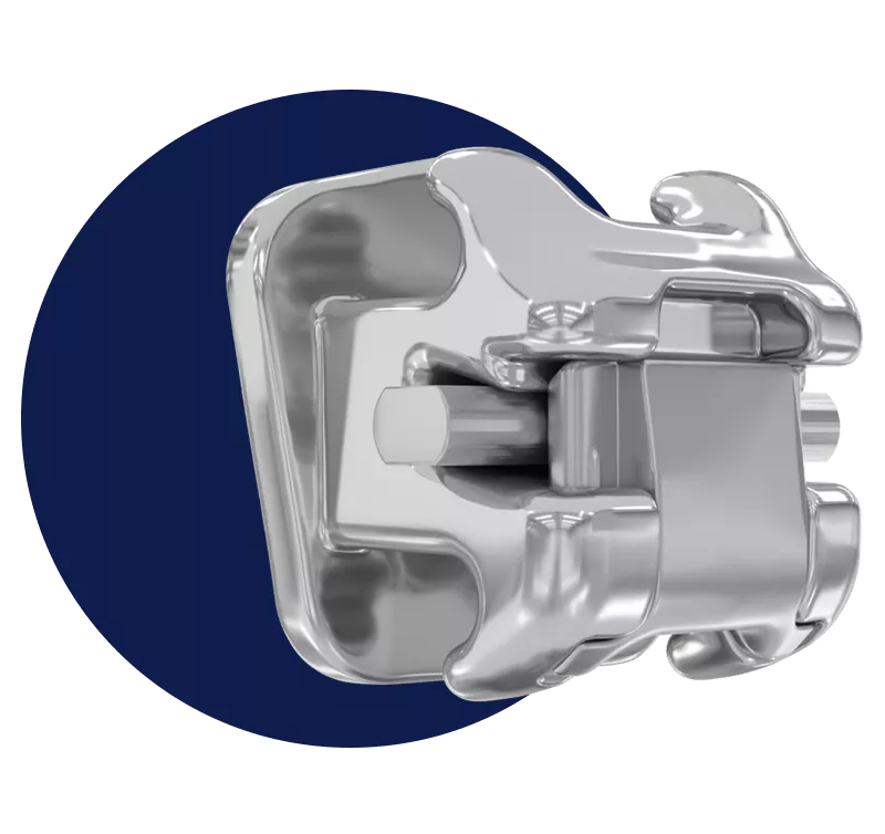 Close-up view of a metallic Damon Ultima orthodontic bracket.