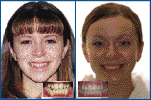 The tremendous impact that the orofacial musculature has on treatment outcome