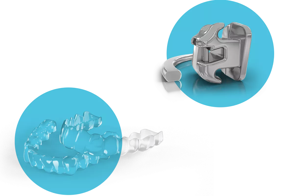Representative Ormco orthodontic solutions showing a clear aligner and a metal bracket