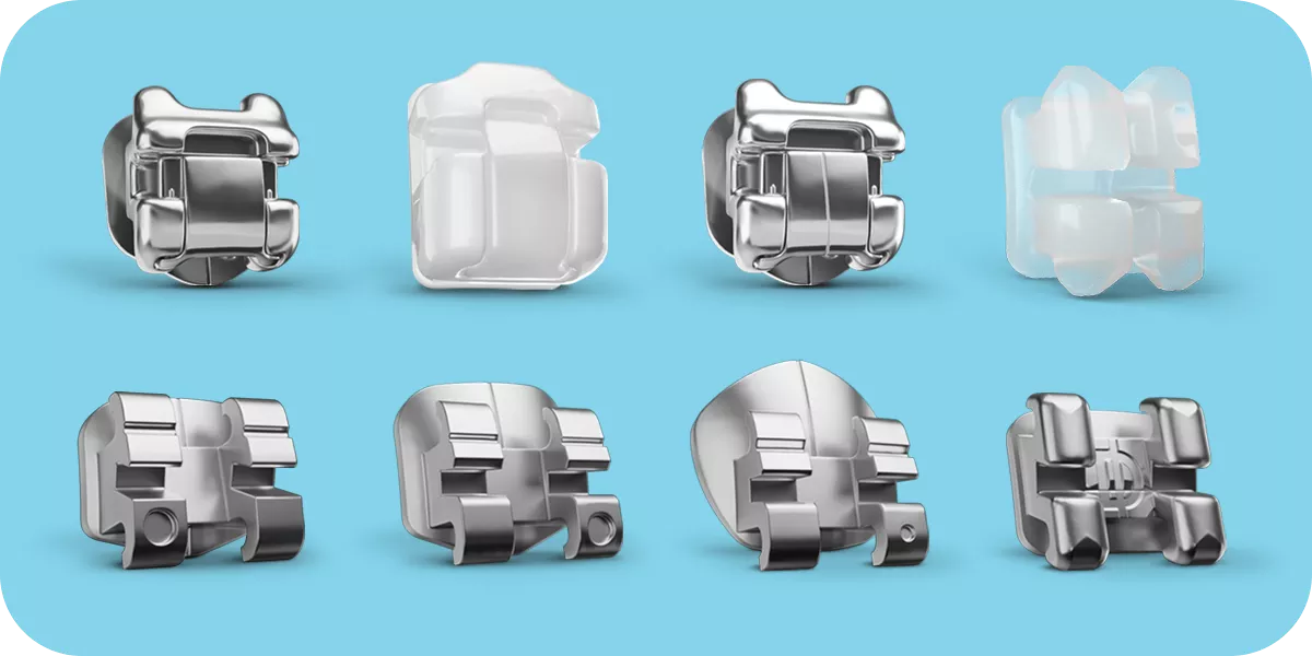 Various orthodontic bracket types displayed, including metal and clear brackets used in digital bonding treatments