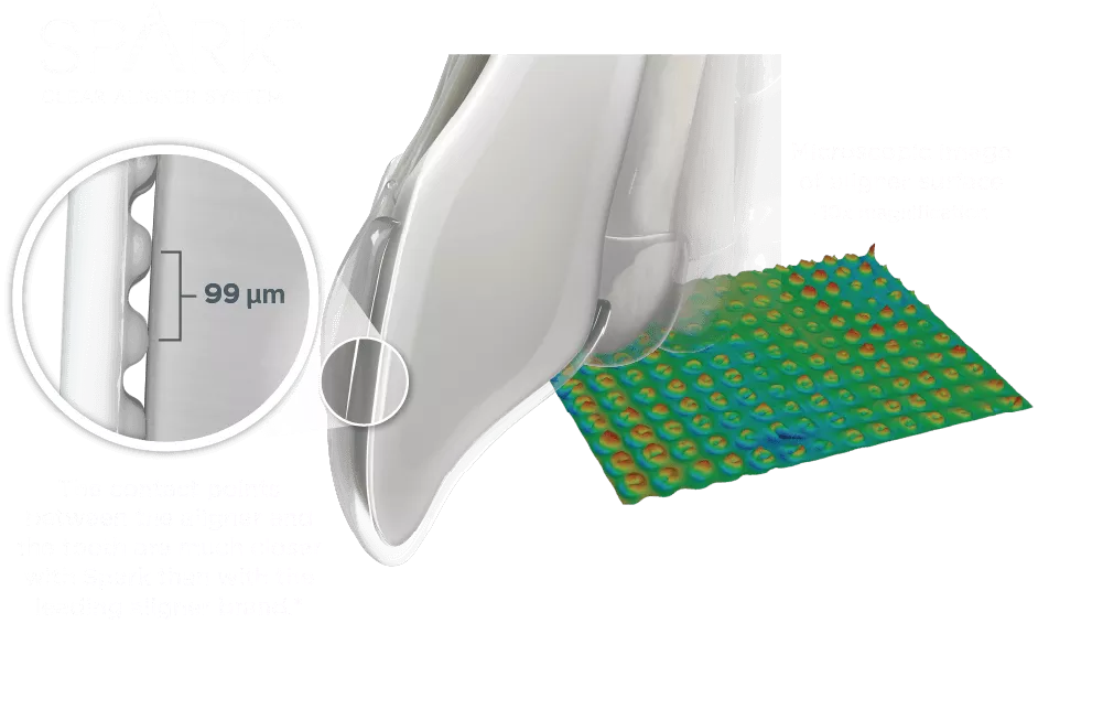 Spark Clear Aligner microscopic view of aligner surface and tooth contact Filename: spark-clear-aligner-surface