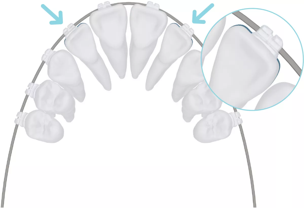 Symetri Clear In/Out Dimensions